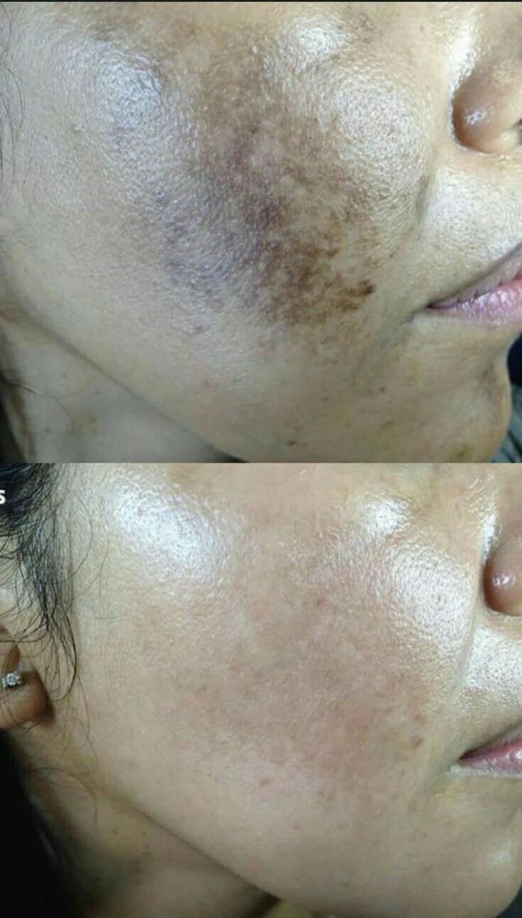 EXFOLIANTE ORANGE 100% ORIGINAL
