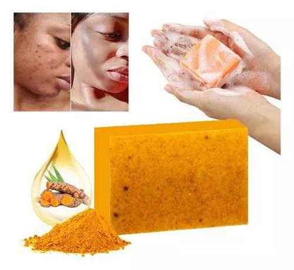 JABON NATURAL DE CURCUMA ORIGINAL